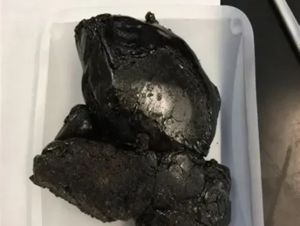 Buy heroin Lithuania online, heroin for sale Lithuania, Lithuania heroin trafficking, online heroin purchase Lithuania, darknet heroin Lithuania, heroin delivery Lithuania, synthetic opioids Lithuania, fentanyl Lithuania, heroin addiction Lithuania, Lithuania drug market, cryptocurrency heroin Lithuania, heroin smuggling Lithuania, illegal heroin sales Lithuania, opioid crisis Lithuania, Lithuania drug enforcement, online drug sale Lithuania, heroin street price Lithuania, Baltic heroin route, Lithuania drug seizures, Vilnius heroin market, Klaipėda heroin trends, Kaunas heroin buyers